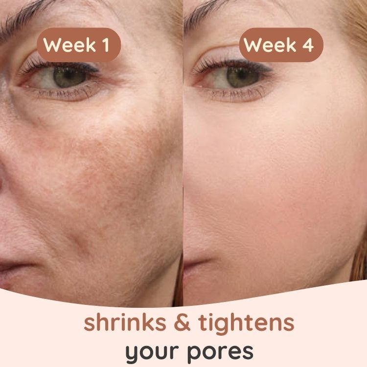 Turmeric & Kojic Cleansing Pads - Zahra Lab
