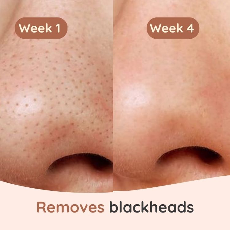 Turmeric & Kojic Cleansing Pads - Zahra Lab