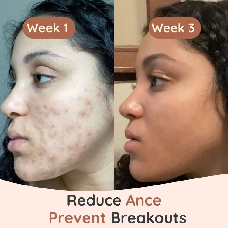 Turmeric & Kojic Cleansing Pads - Zahra Lab